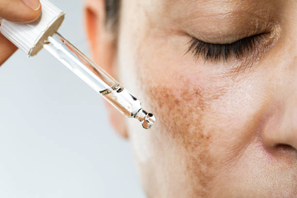 How to Hydrate and Brighten Dry Skin Simultaneously with Cream