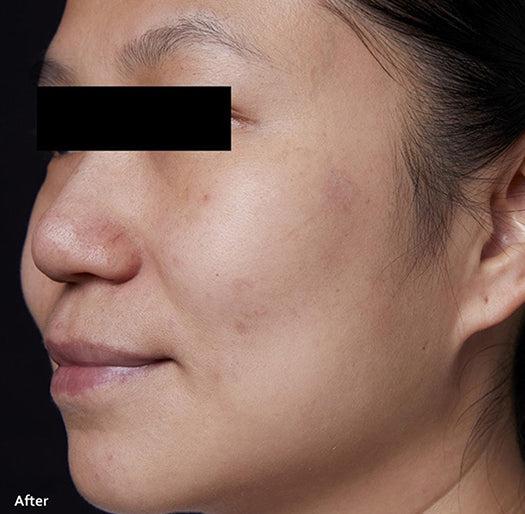 Brightening Cream results