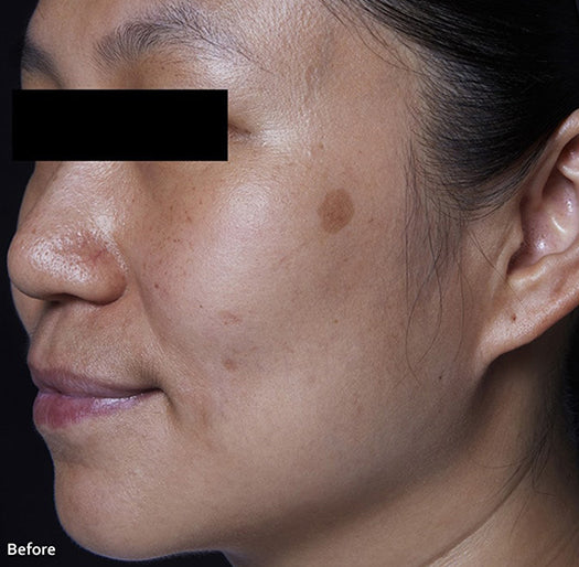 Brightening Cream results